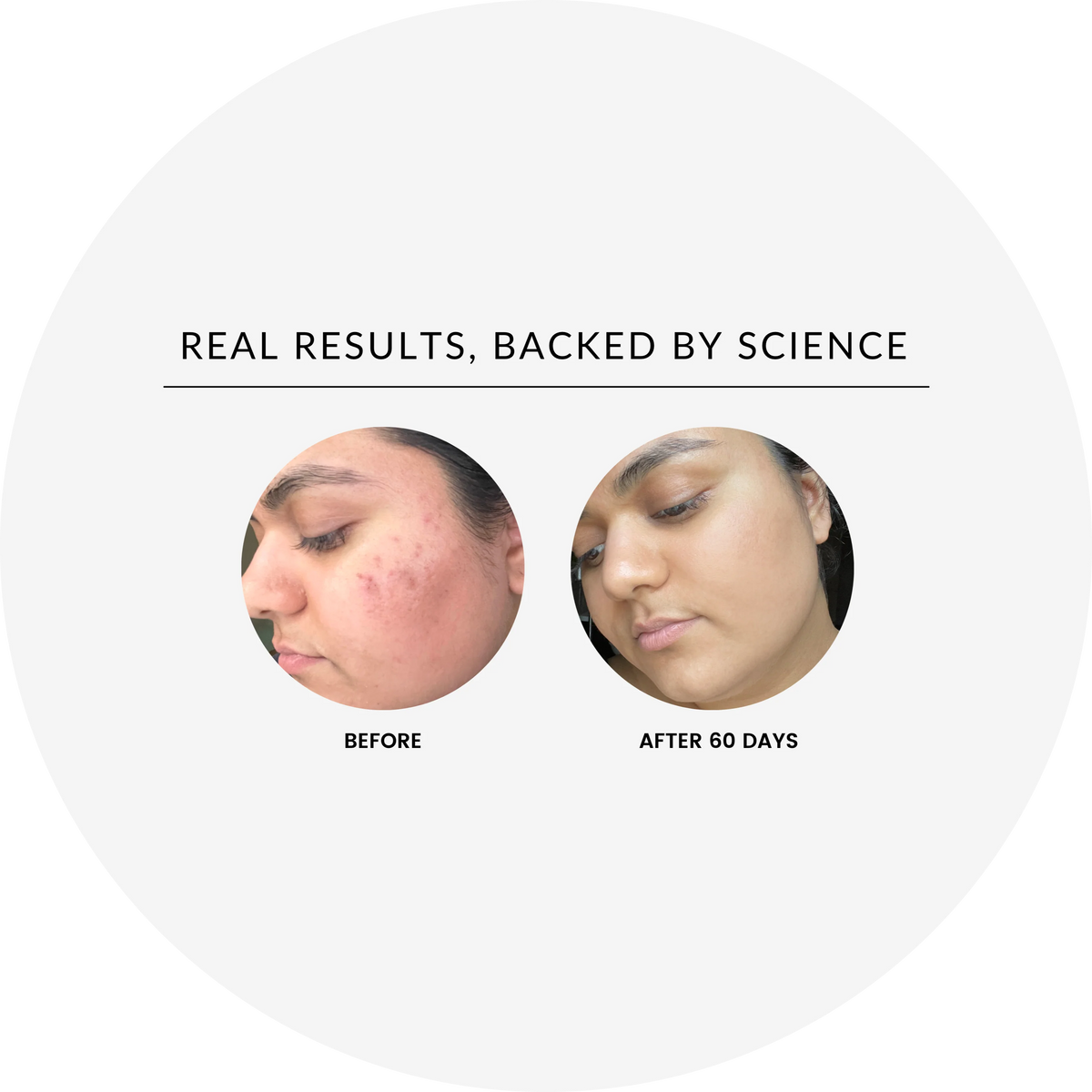 Before and after images showing results from THE VITAMIN C BRIGHTENING SERUM after 60 days of use.