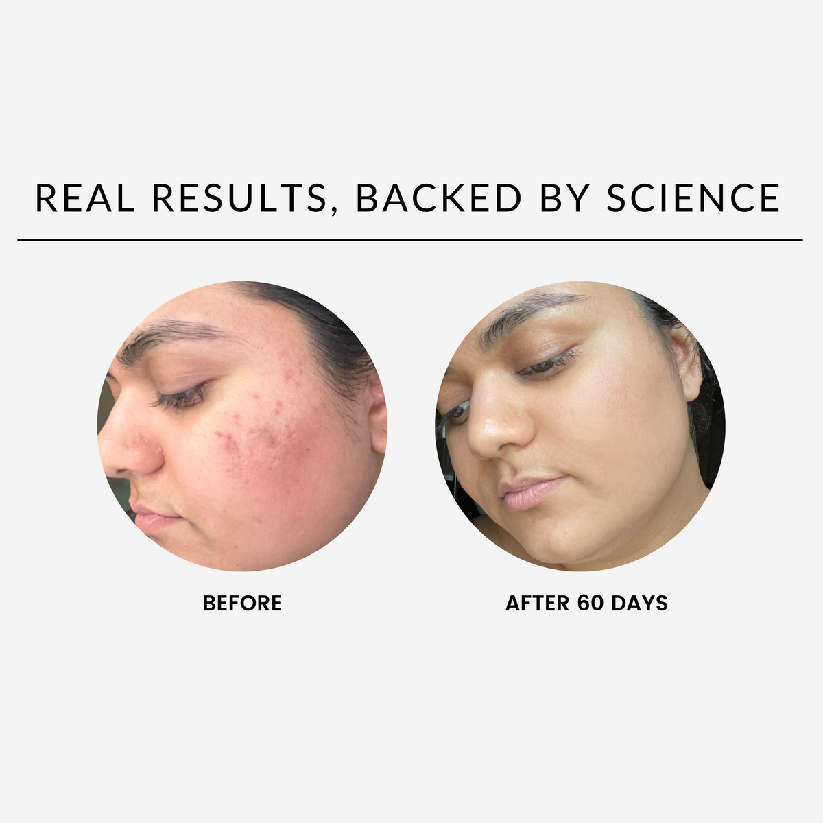 Before and after image showing skin improvement from using OVERNIGHT GLOW UP over 60 days.